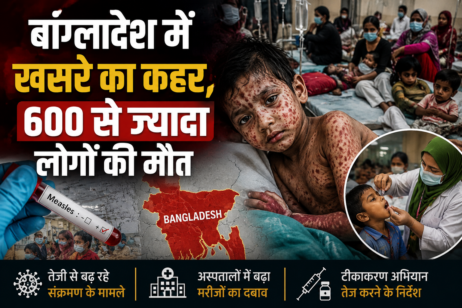 बांग्लादेश में खसरे का कहर, 600 से ज्यादा लोगों की मौत